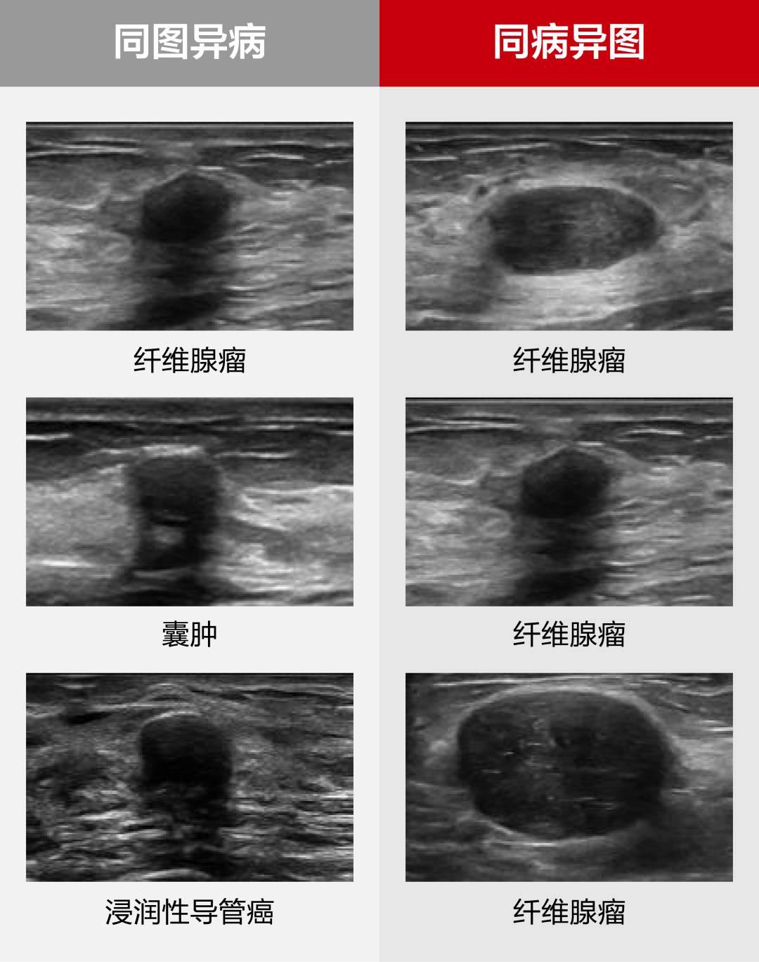 破局“她健康”，迈瑞医疗领跑数智影像新赛道-第2张图片-悦刻网上商城官方网站-正品优惠，尽在悦刻官方网站